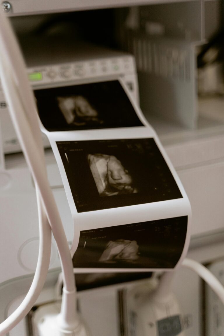 Printed pictures of an ultrasound of a baby | What to expect at your first ultrasound | Mary's Refuge, Martinsburg WV