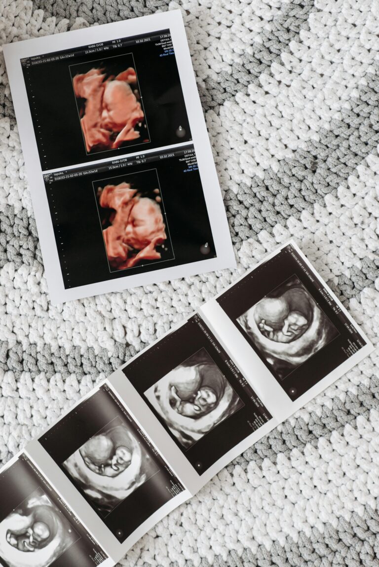 Ultrasound photos of a baby | How often do I need to get an ultrasound | Mary's Refuge, Martinsburg WV