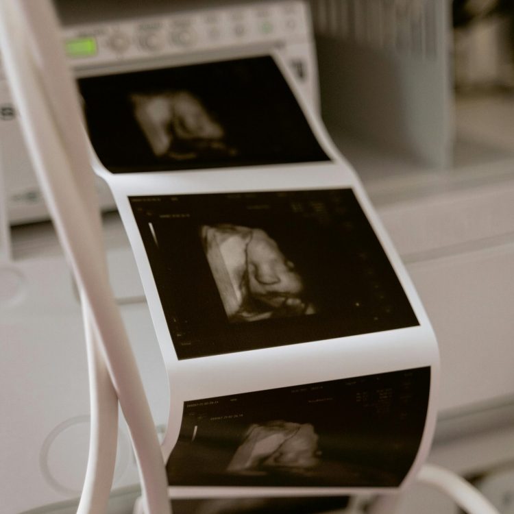 Printed pictures of an ultrasound of a baby | What to expect at your first ultrasound | Mary's Refuge, Martinsburg WV