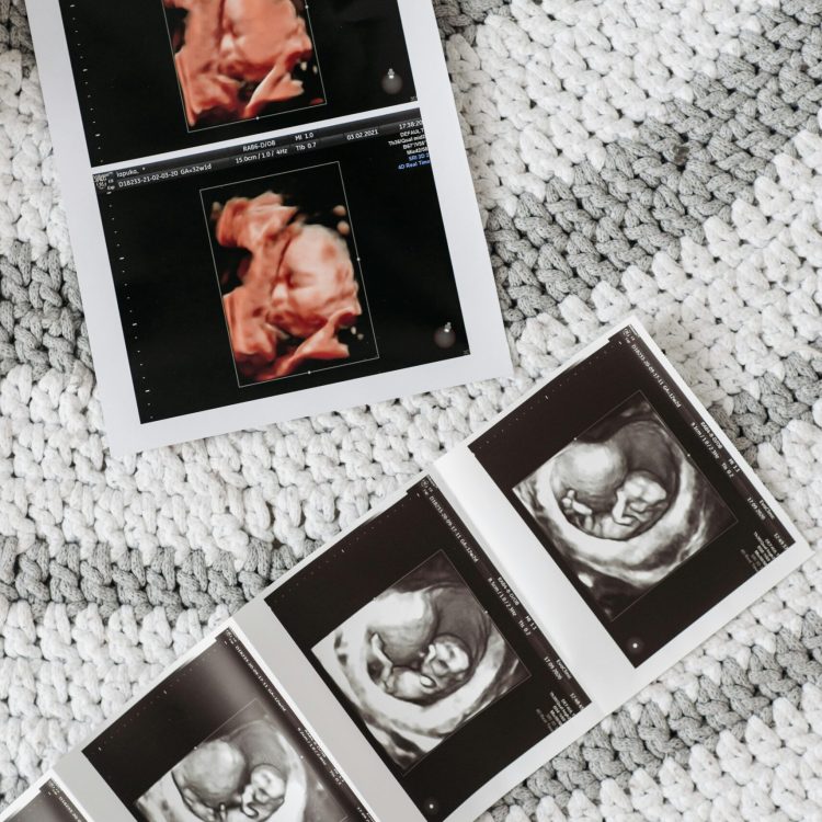 Ultrasound photos of a baby | How often do I need to get an ultrasound | Mary's Refuge, Martinsburg WV